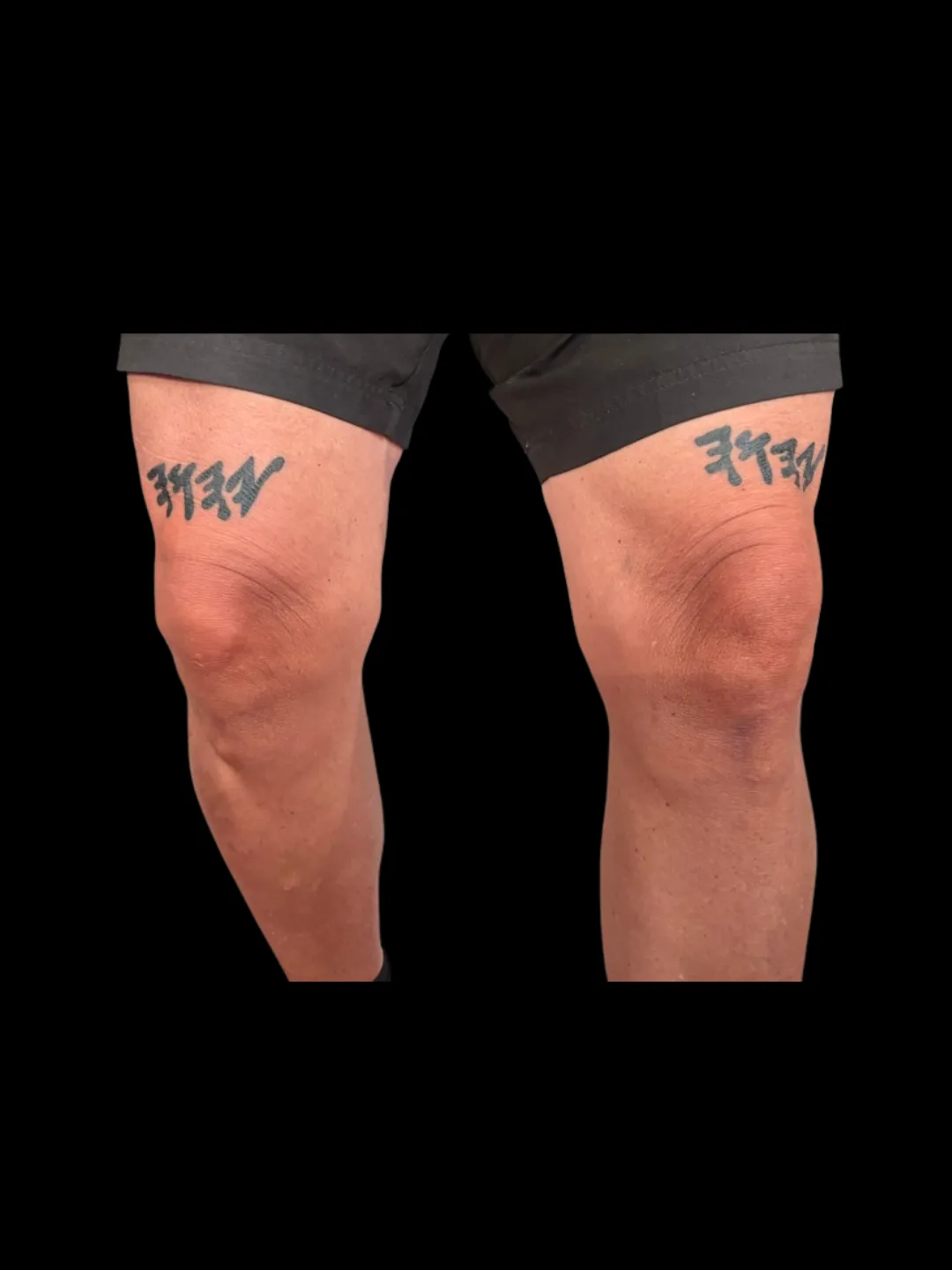 Knees
